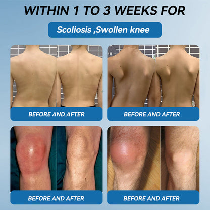 𝖯𝗂𝖼𝗱𝗼® BPC-157 Joint Healing Cream🦴Treats Arthritis, Neuropathy, Rheumatism, Sports Injuries & More-USA👍