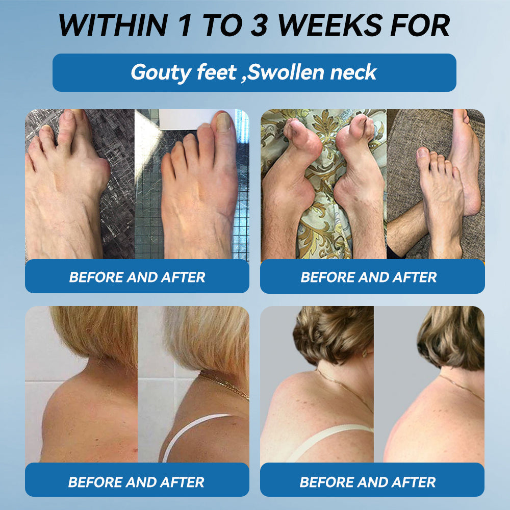 𝖯𝗂𝖼𝗱𝗼® BPC-157 Joint Healing Cream🦴Treats Arthritis, Neuropathy, Rheumatism, Sports Injuries & More-USA👍