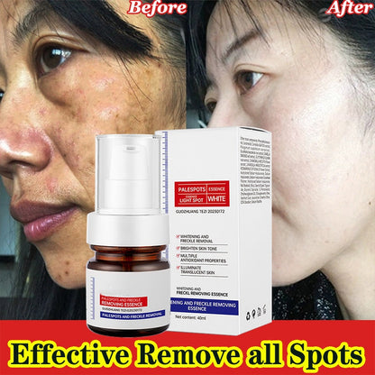 ⚡5-second brightening rescue: Dark spots disappear, blemishes fade, and skin becomes radiant! Vitamin C Whitening Freckles - Lefreniy