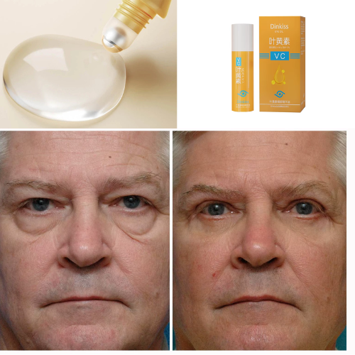 Rolon Ultra Rejuvenesced 5-in-1 Letein Glow