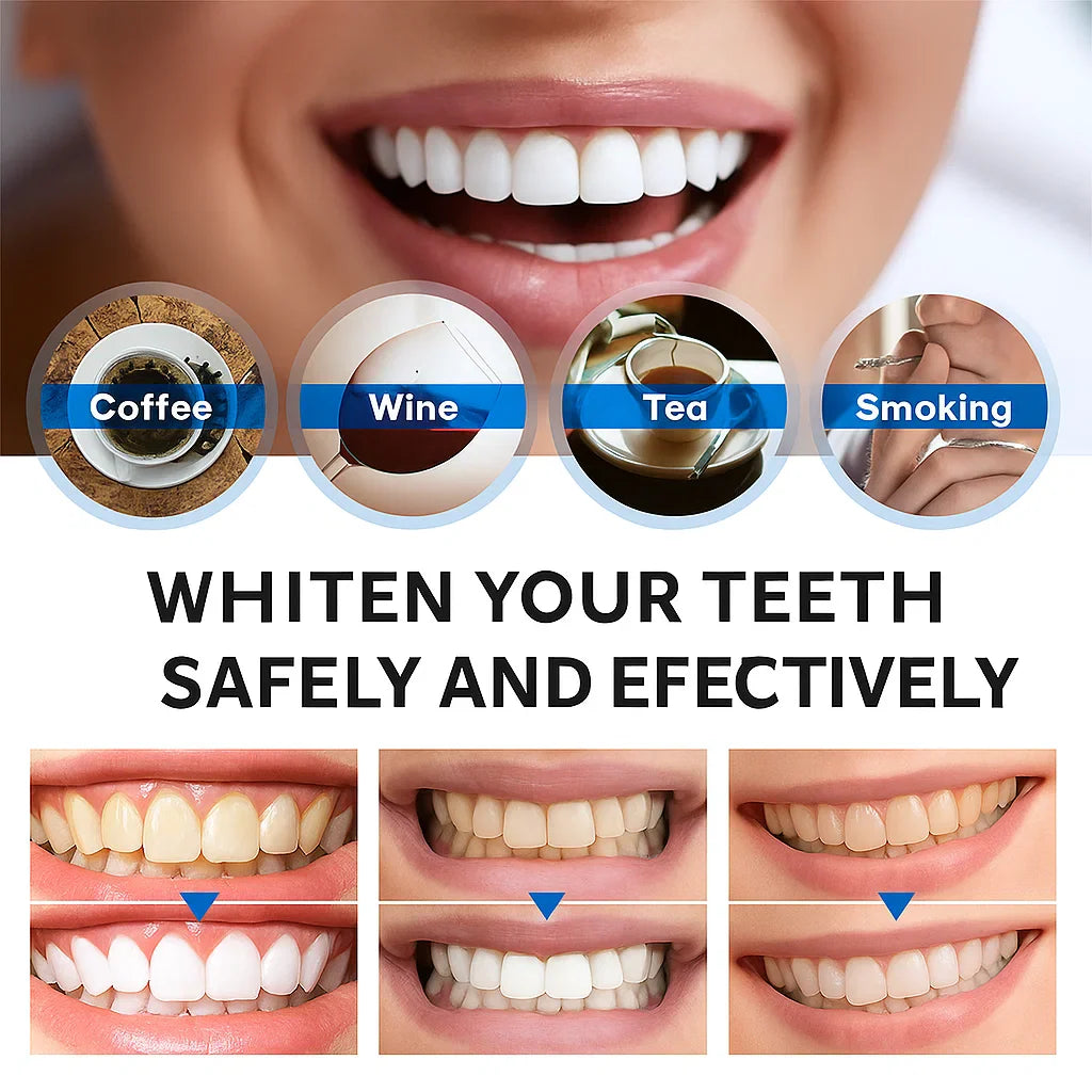 Instant Bright Teeth Whitening Essence Pen – Gentle & Sensitivity-Free