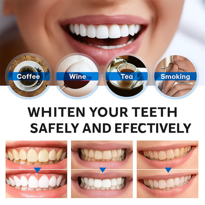 Instant Bright Teeth Whitening Essence Pen – Gentle & Sensitivity-Free