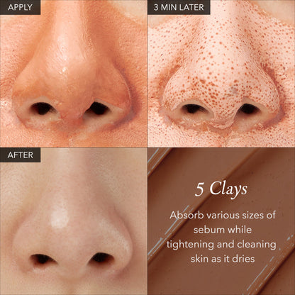 🎁🎁Limited-Time Promotion: 25% Off for 1 Item, 35% Off for 2 Items：Carrotene IPMP™ Quick Dry Pore Tightening Clay Mask
