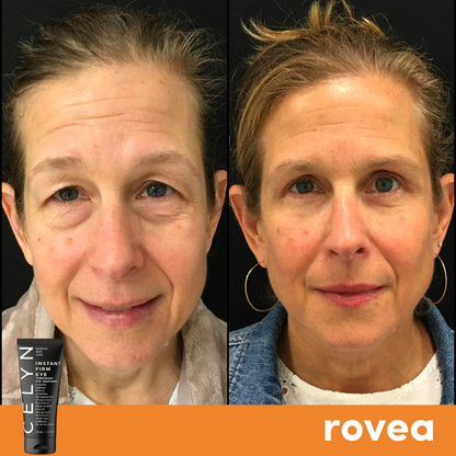 Instant Eye Cream for Dark Circles and Wrinkles