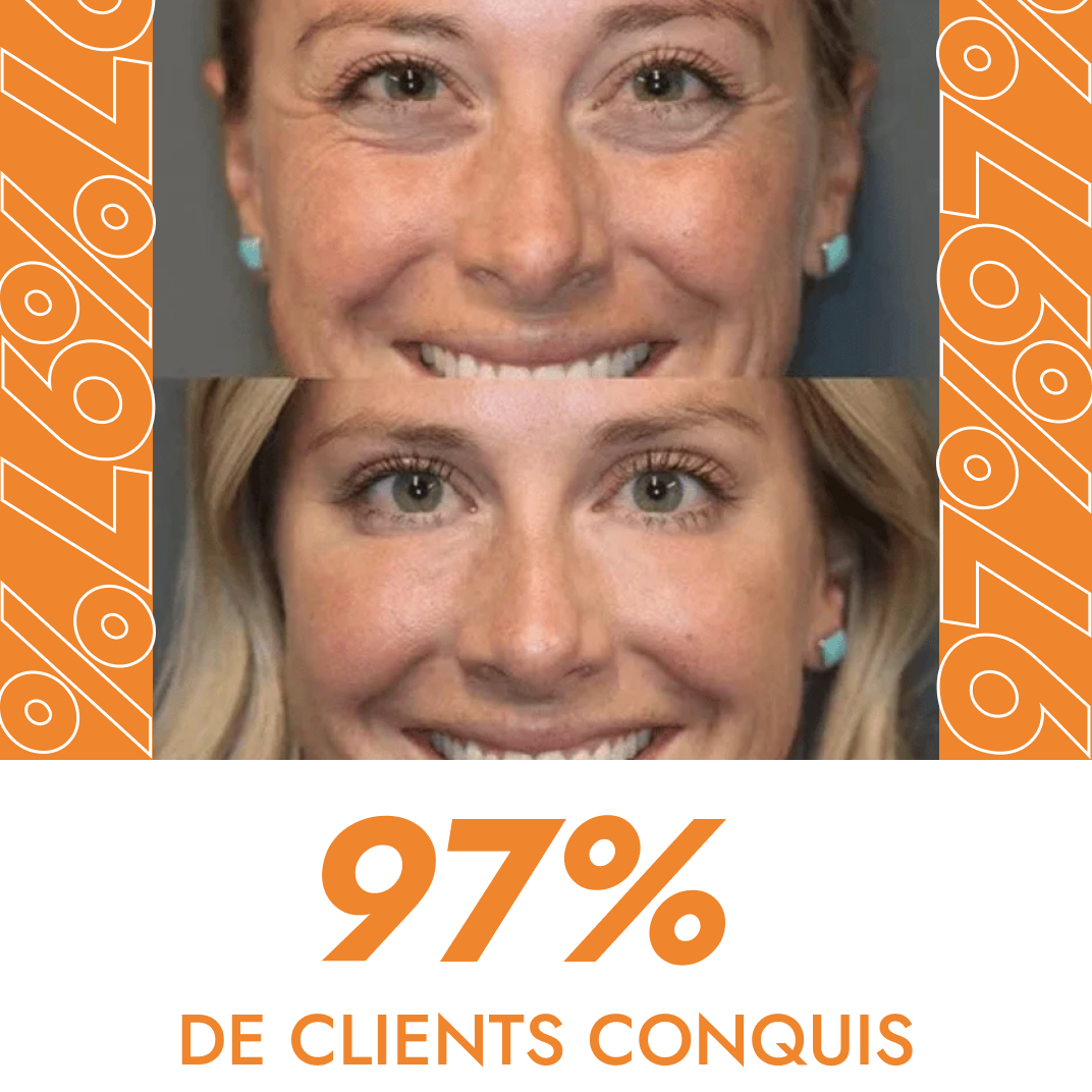 Instant Eye Cream for Dark Circles and Wrinkles